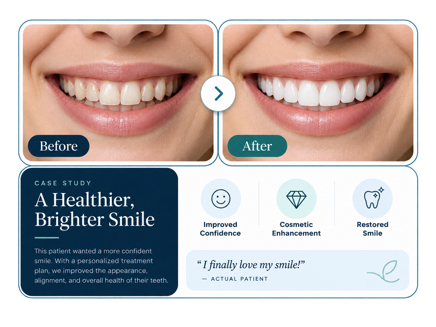 Illustrative before-and-after smile gallery module design concept