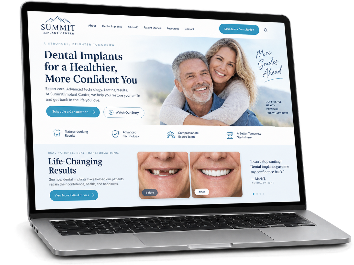 Dental implant website concept displayed on a laptop
